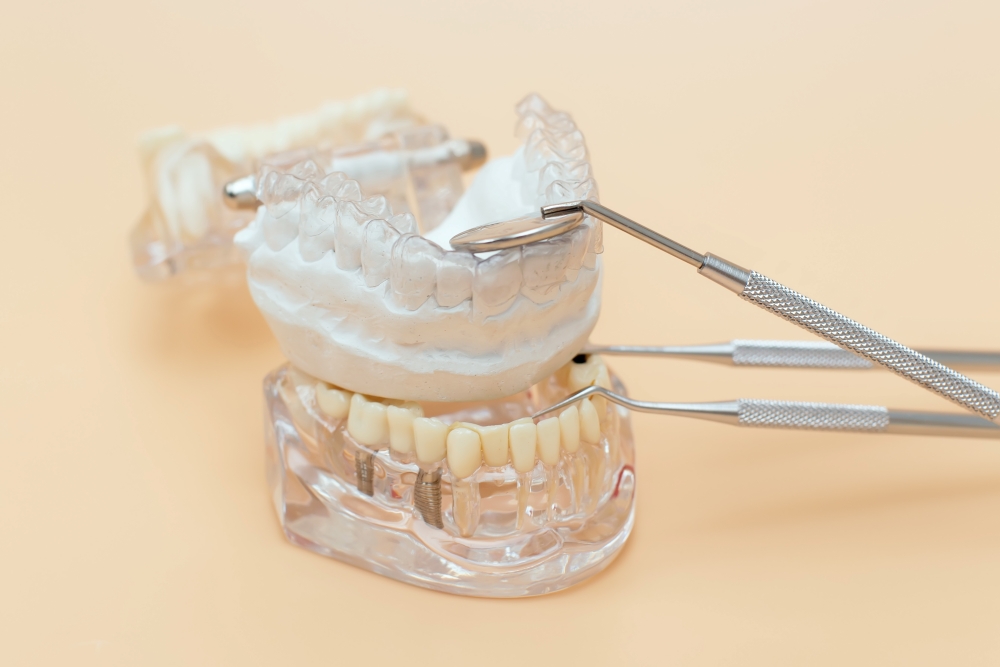 Diş protez laboratuvarı ve malzemeleri