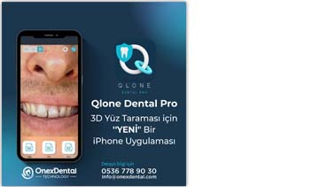 Qlone Denta Dental Sistemi