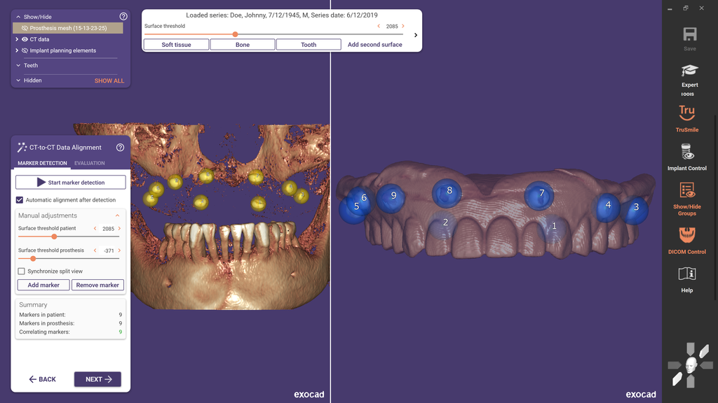 https://www.onexdental.com/yuklemeler/gorsel/04_dual-scan_protocol.png