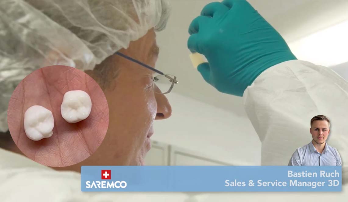 https://www.onexdental.com/yuklemeler/gorsel/6-renk-sonlandirma-saremco-print-crowntec_1.jpg