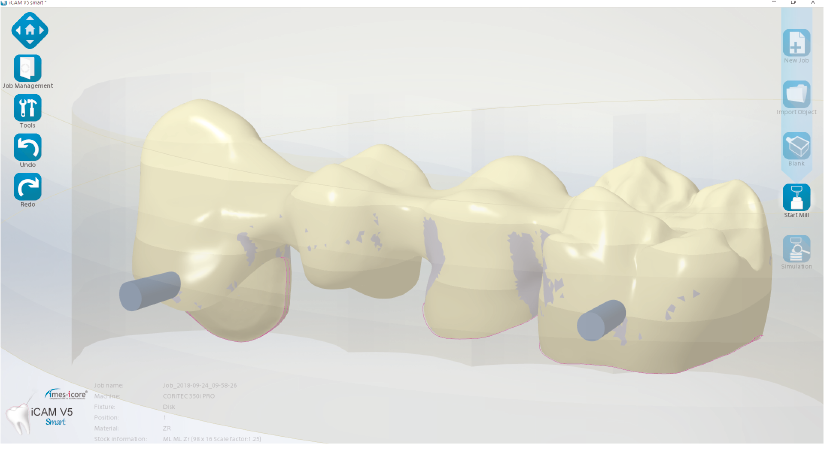 https://www.onexdental.com/yuklemeler/gorsel/c5.png