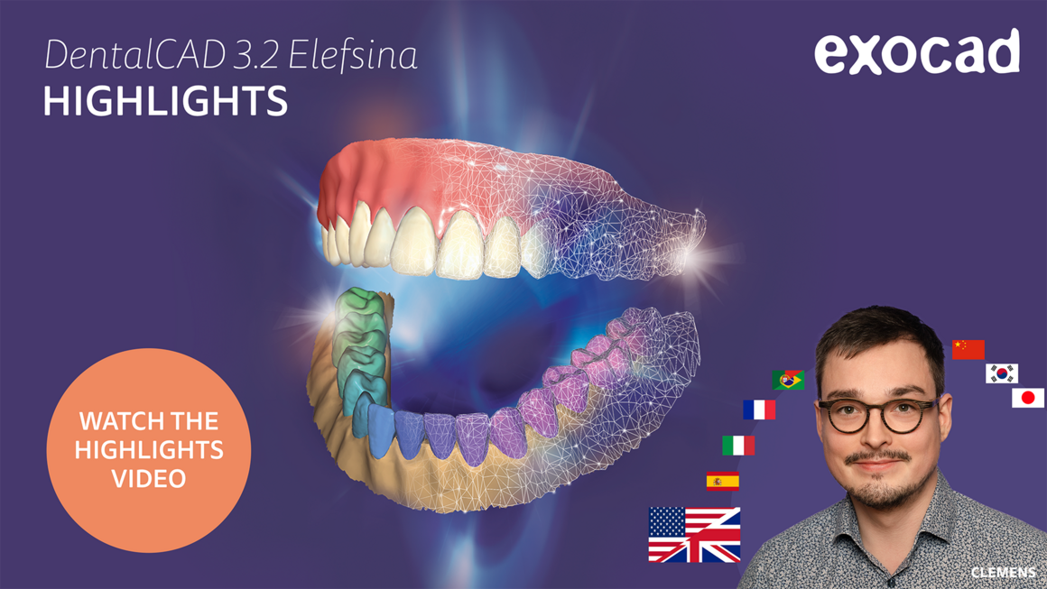 https://www.onexdental.com/yuklemeler/gorsel/csm_dentalcad_3-2_highlights__en_hd_d878a528b1-webp.jpg