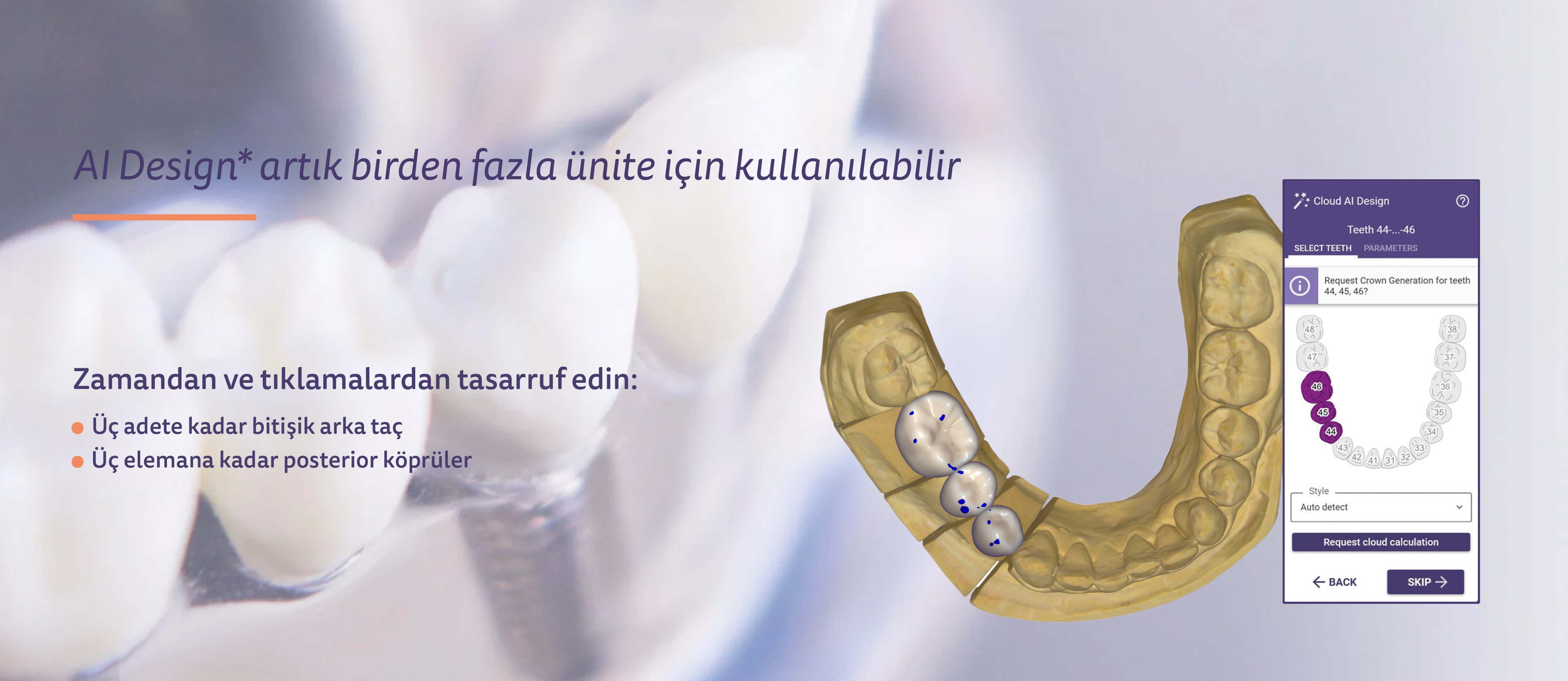 https://www.onexdental.com/yuklemeler/gorsel/exocad-site25-go-rseller-3.jpg