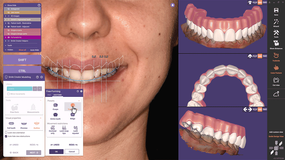 https://www.onexdental.com/yuklemeler/gorsel/exocad_dentalcad_elefsina_features_2_smile_creator_03.jpg