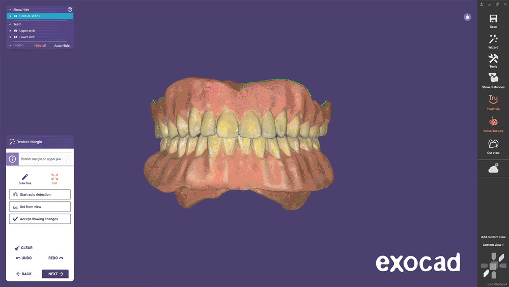 https://www.onexdental.com/yuklemeler/gorsel/exocad_dentalcad_elefsina_features_4_copy_denture.jpg