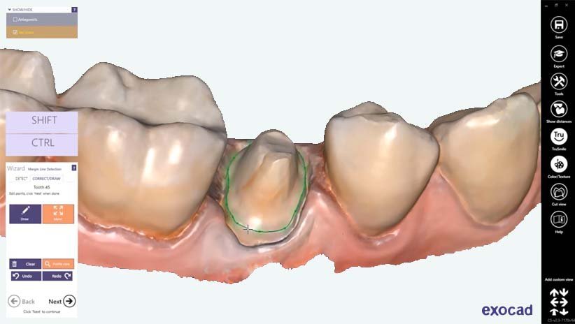 https://www.onexdental.com/yuklemeler/gorsel/f5-copy.jpg