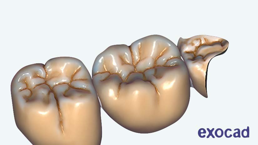 https://www.onexdental.com/yuklemeler/gorsel/f6-copy-yeni.jpg