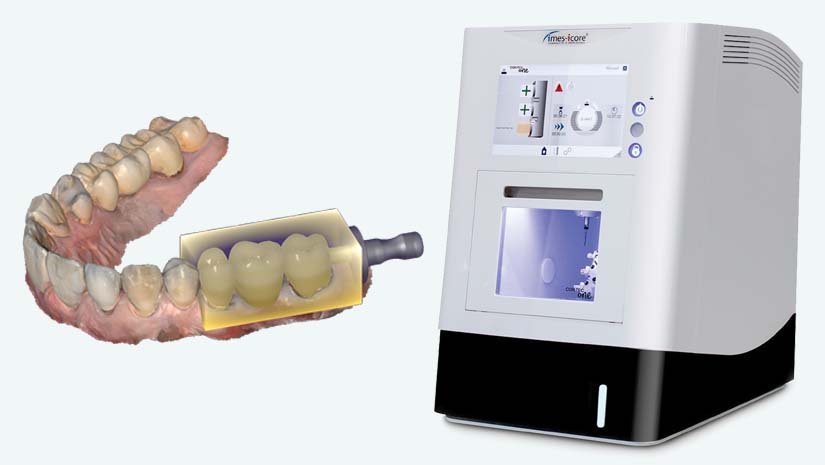 https://www.onexdental.com/yuklemeler/gorsel/f7-copy.jpg