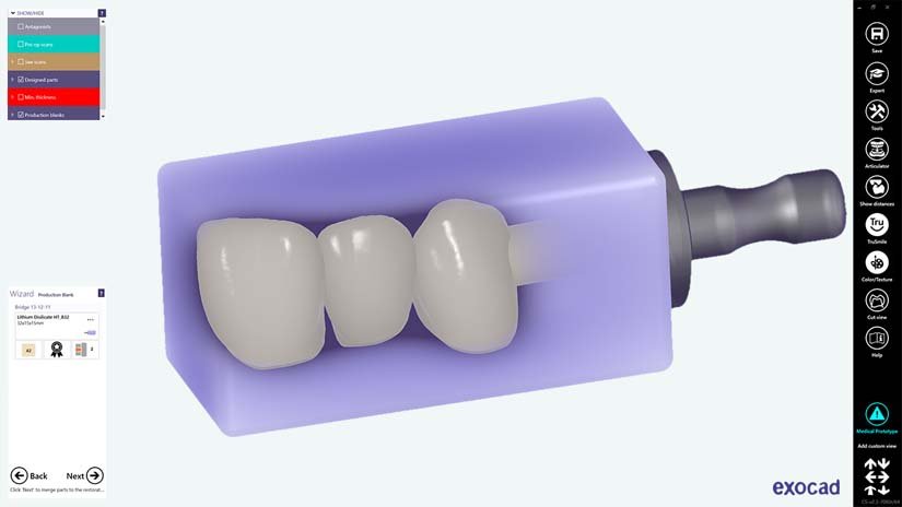 https://www.onexdental.com/yuklemeler/gorsel/f8-copy.jpg
