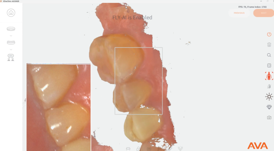 https://www.onexdental.com/yuklemeler/gorsel/how-ava-works-1.png