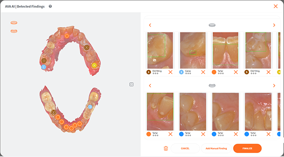 https://www.onexdental.com/yuklemeler/gorsel/how-ava-works-2.png