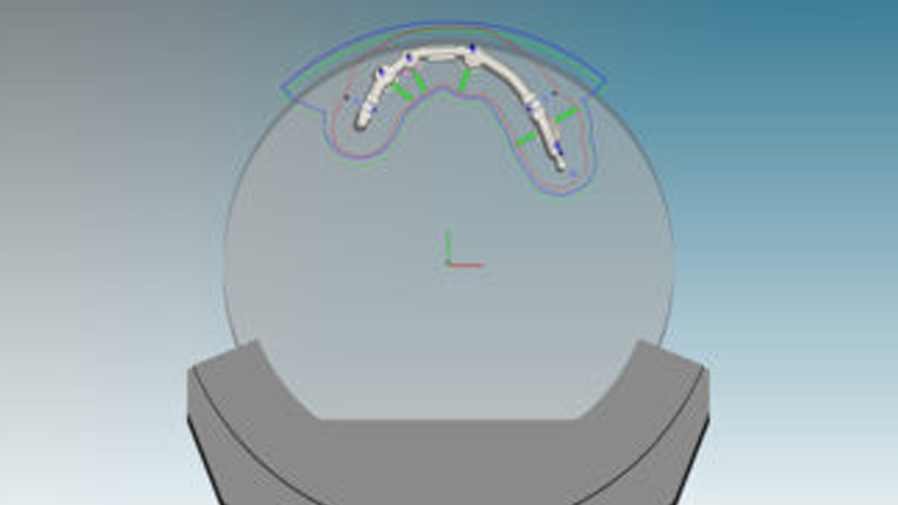 https://www.onexdental.com/yuklemeler/gorsel/hyperdent_c-kelepce.png