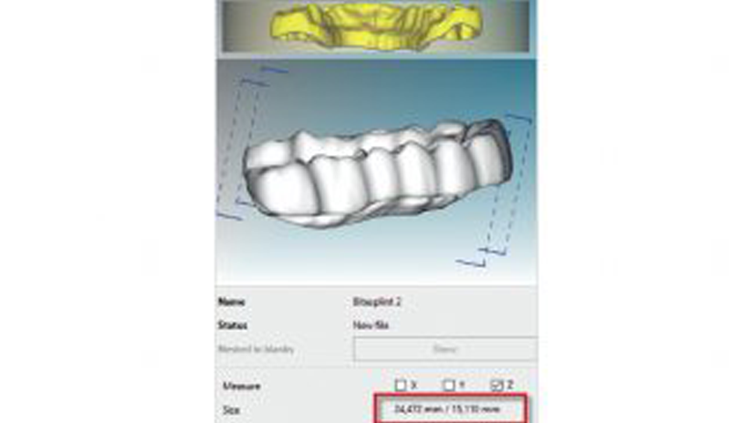 https://www.onexdental.com/yuklemeler/gorsel/hyperdent_cevre-filtresi.png