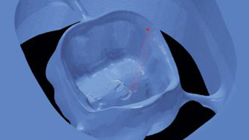 https://www.onexdental.com/yuklemeler/gorsel/hyperdent_gravu-r.png