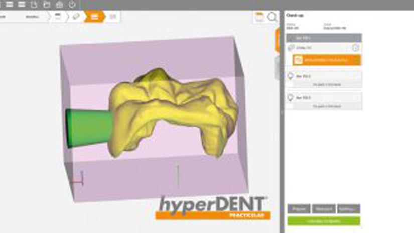 https://www.onexdental.com/yuklemeler/gorsel/hyperdent_konekto-r-ayari.png
