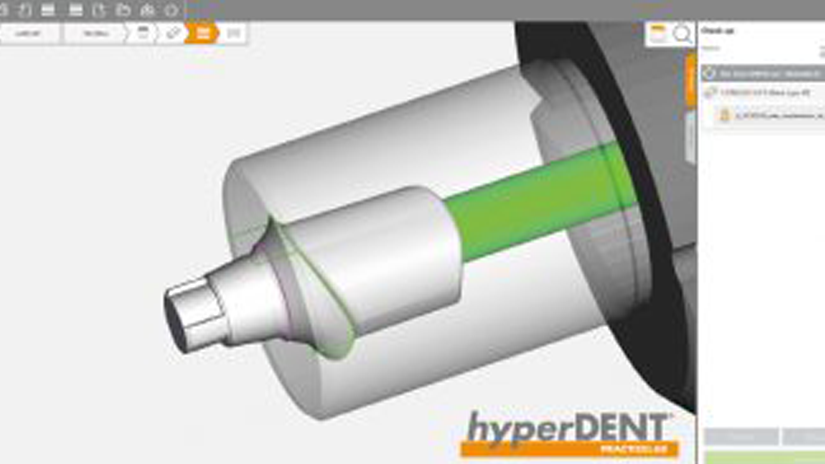 https://www.onexdental.com/yuklemeler/gorsel/hyperdent_prefabrik-frezeleme.png