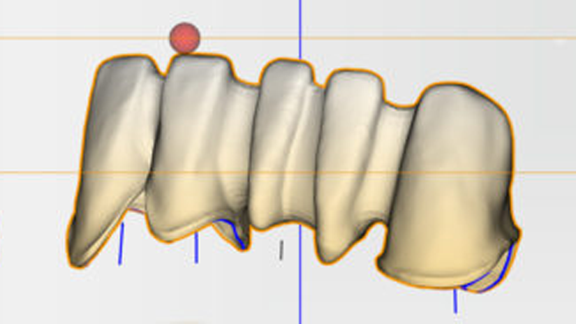 https://www.onexdental.com/yuklemeler/gorsel/hyperdent_renk-gradyan.png