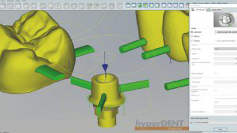 https://www.onexdental.com/yuklemeler/gorsel/hyperdent_sinterleme.png