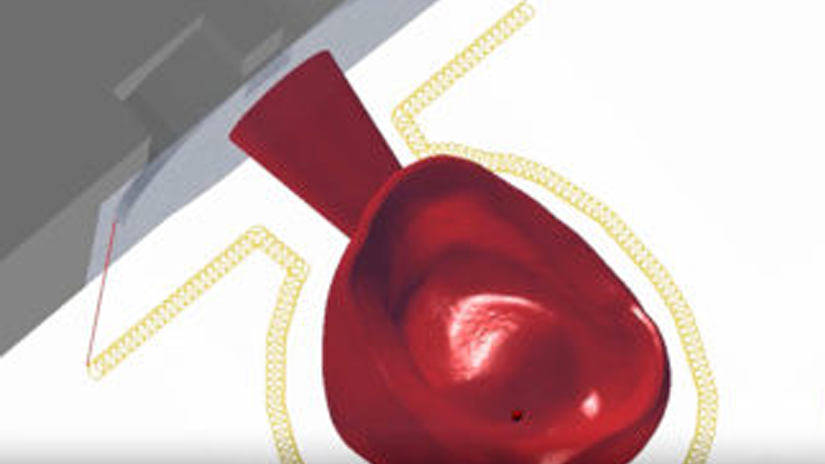 https://www.onexdental.com/yuklemeler/gorsel/hyperdent_trokoidal-frezeleme.png