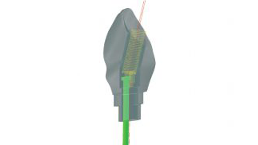 https://www.onexdental.com/yuklemeler/gorsel/hyperdent_vida-kanallari.png