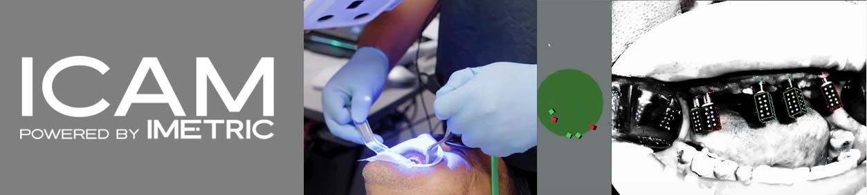 https://www.onexdental.com/yuklemeler/gorsel/icam-yatay-go-rsel-1024x512_1.jpg
