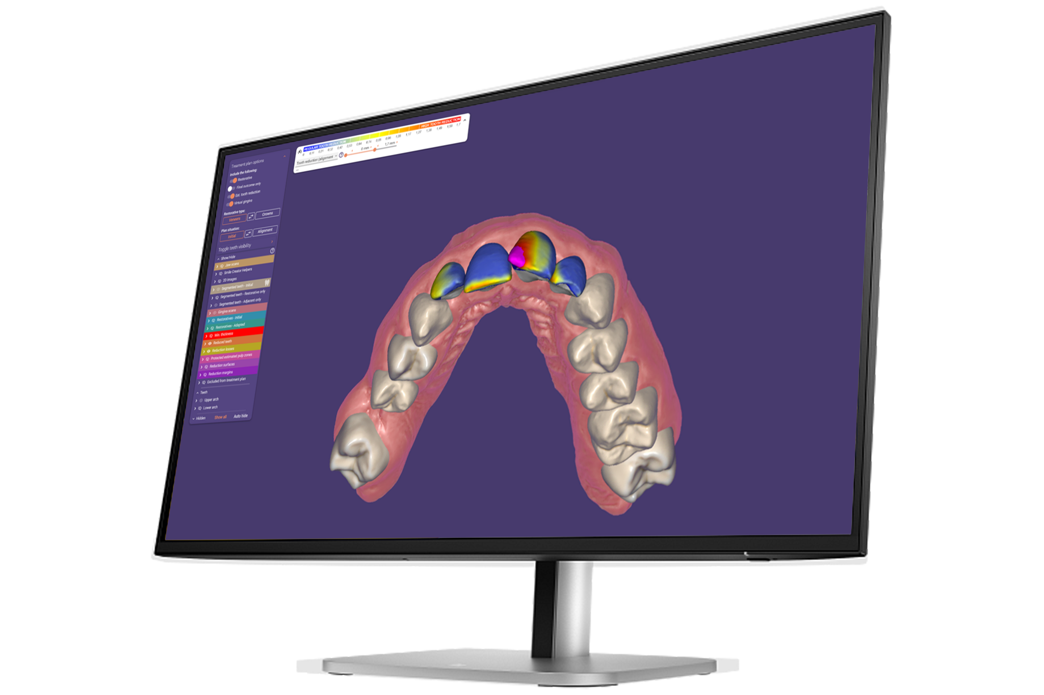 https://www.onexdental.com/yuklemeler/gorsel/onex-hp-9d9s0ut-monito-r-exocad.png