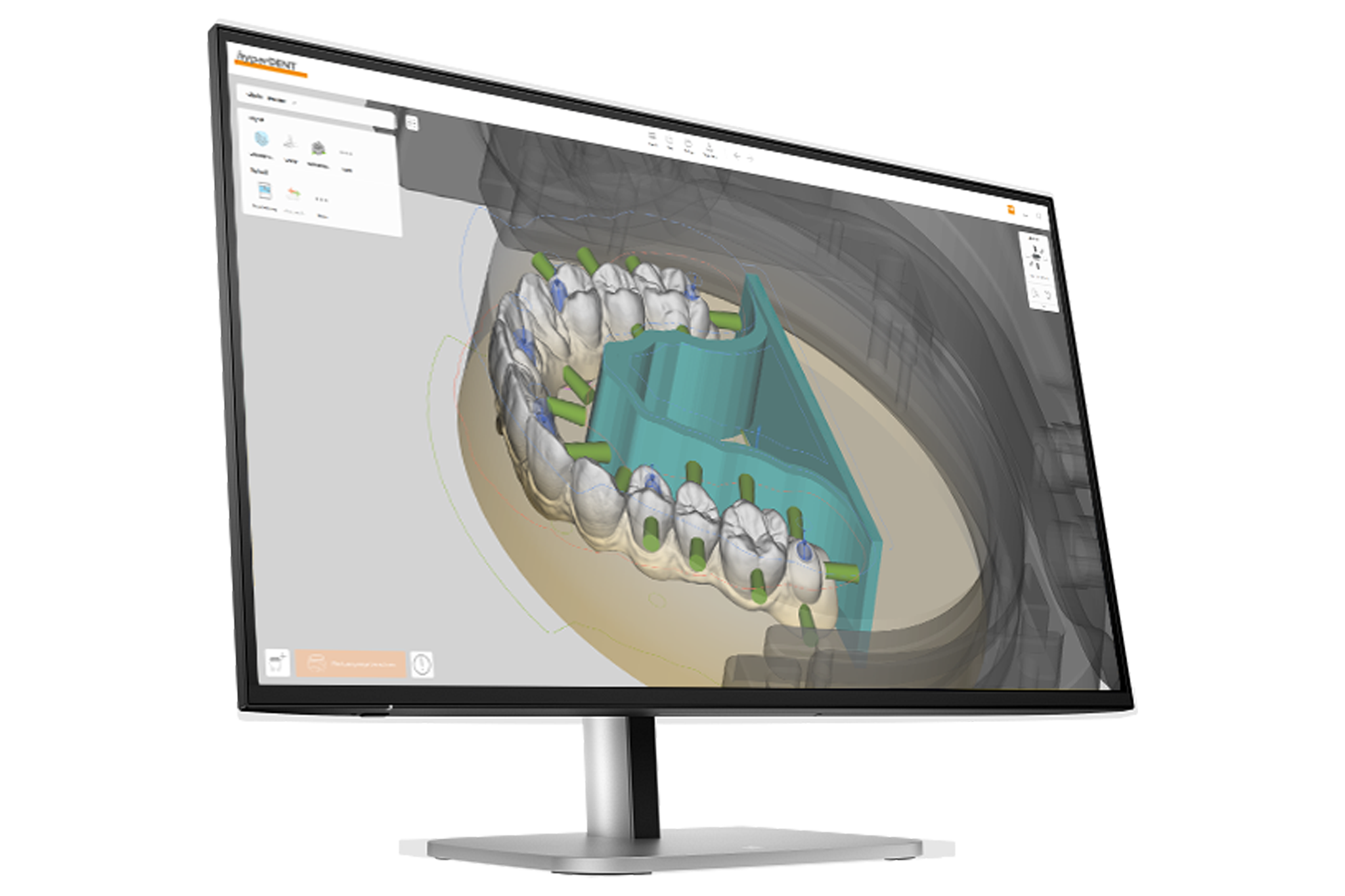 https://www.onexdental.com/yuklemeler/gorsel/onex-hp-9d9s0ut-monito-r-hyper.png