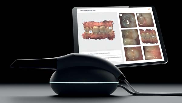 https://www.onexdental.com/yuklemeler/gorsel/ova-ana-p6-beyazdan_1.jpg