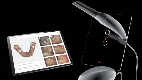 https://www.onexdental.com/yuklemeler/gorsel/ova-ana-p6-beyazdan_2web.jpg