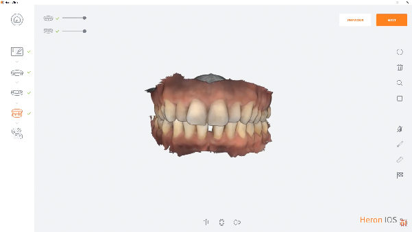 https://www.onexdental.com/yuklemeler/gorsel/p10-copy22.png