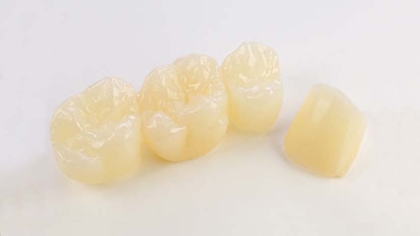 https://www.onexdental.com/yuklemeler/gorsel/prididenta-o3_25-copy.jpg