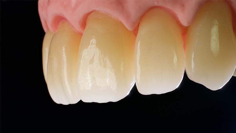 https://www.onexdental.com/yuklemeler/gorsel/prididenta-o3_26-copy.jpg
