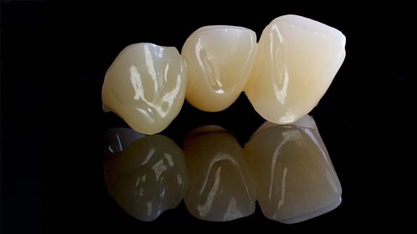 https://www.onexdental.com/yuklemeler/gorsel/prididenta-o3_27-copy.jpg