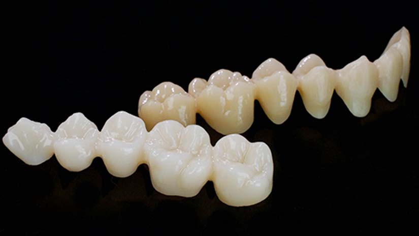 https://www.onexdental.com/yuklemeler/gorsel/prididenta-o3_30-copy.jpg