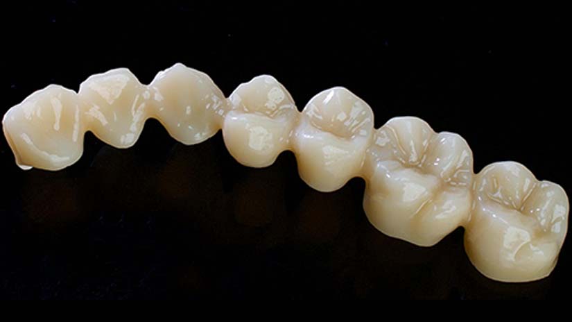 https://www.onexdental.com/yuklemeler/gorsel/prididenta-o3_32-copy.jpg