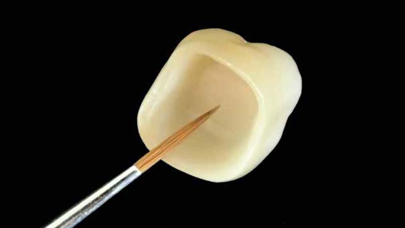 https://www.onexdental.com/yuklemeler/gorsel/prididenta-o3_33-copy.jpg
