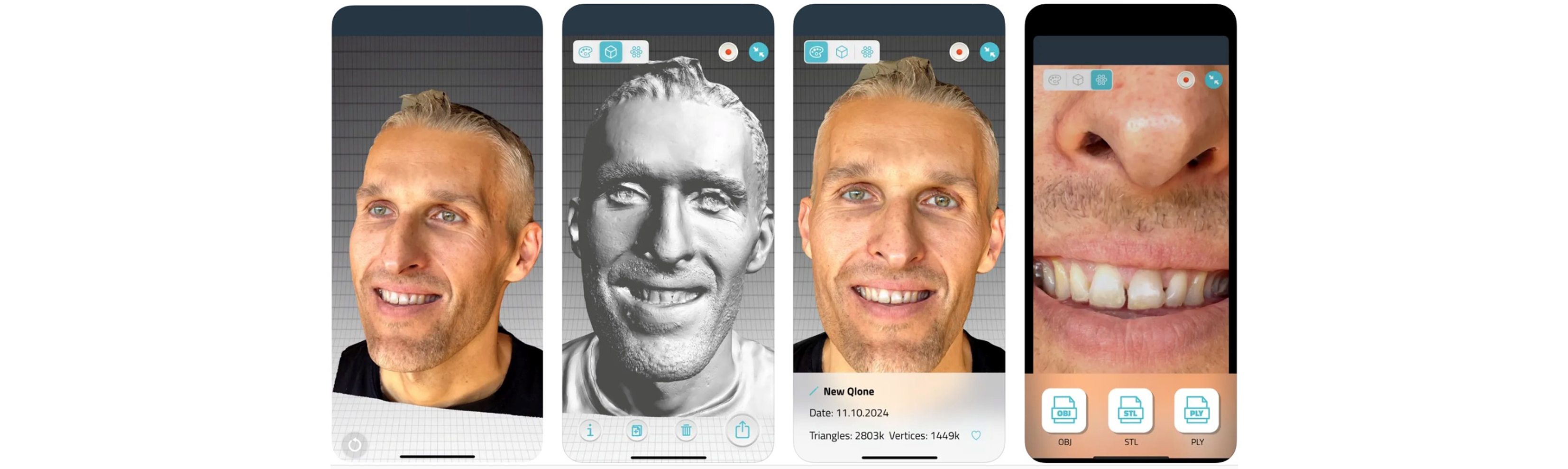 https://www.onexdental.com/yuklemeler/gorsel/qlone-dental-uygilama-go-ru-ntu-leri1.jpg