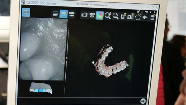 https://www.onexdental.com/yuklemeler/gorsel/zebris-p6-beyazdan-yeni_2.jpg