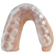 https://www.onexdental.com/yuklemeler/ikon/splint-on-model-1x1-1.png
