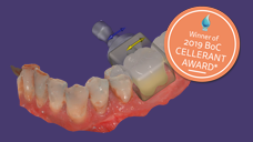 https://www.onexdental.com/yuklemeler/ikon/p110.png