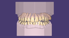 https://www.onexdental.com/yuklemeler/ikon/p120-copy.png