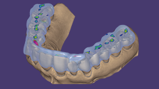https://www.onexdental.com/yuklemeler/ikon/p130-copy.png