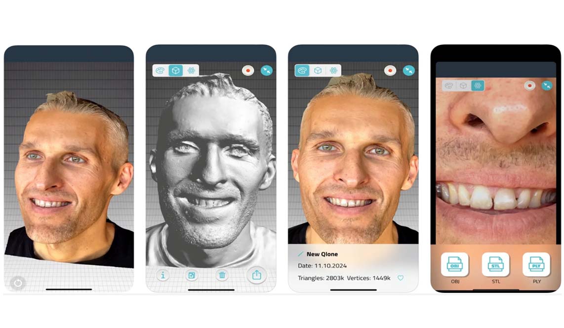 Qlone Dental Pro              3D YÜZ TARAYICI