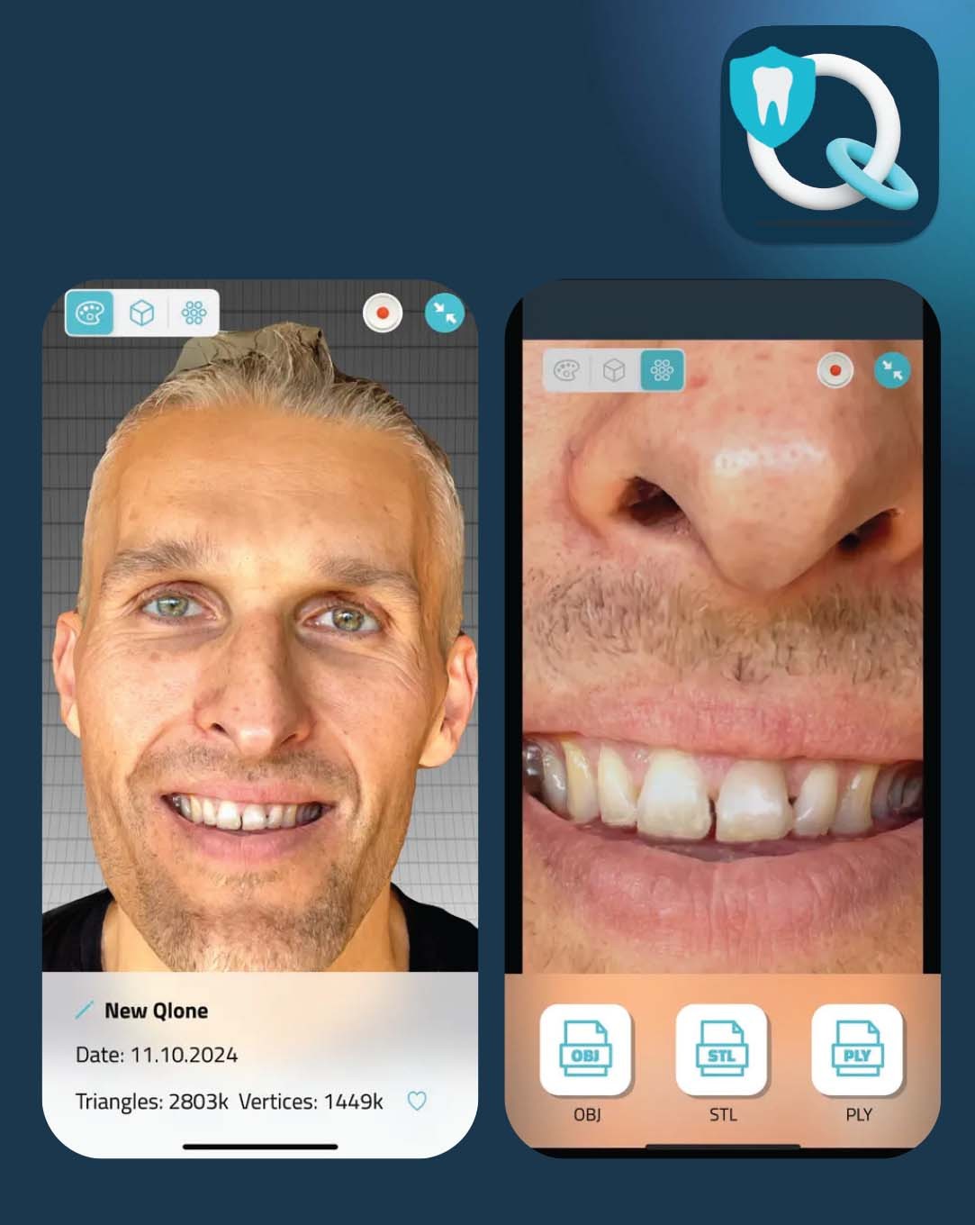 Qlone Dental Pro              3D YÜZ TARAYICI